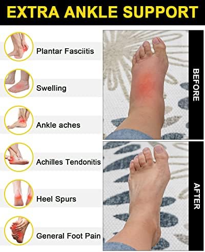 Aoliks Compression Socks for Plantar Fasciitis Relief Aoliks Compression Socks for Plantar Fasciitis Relief