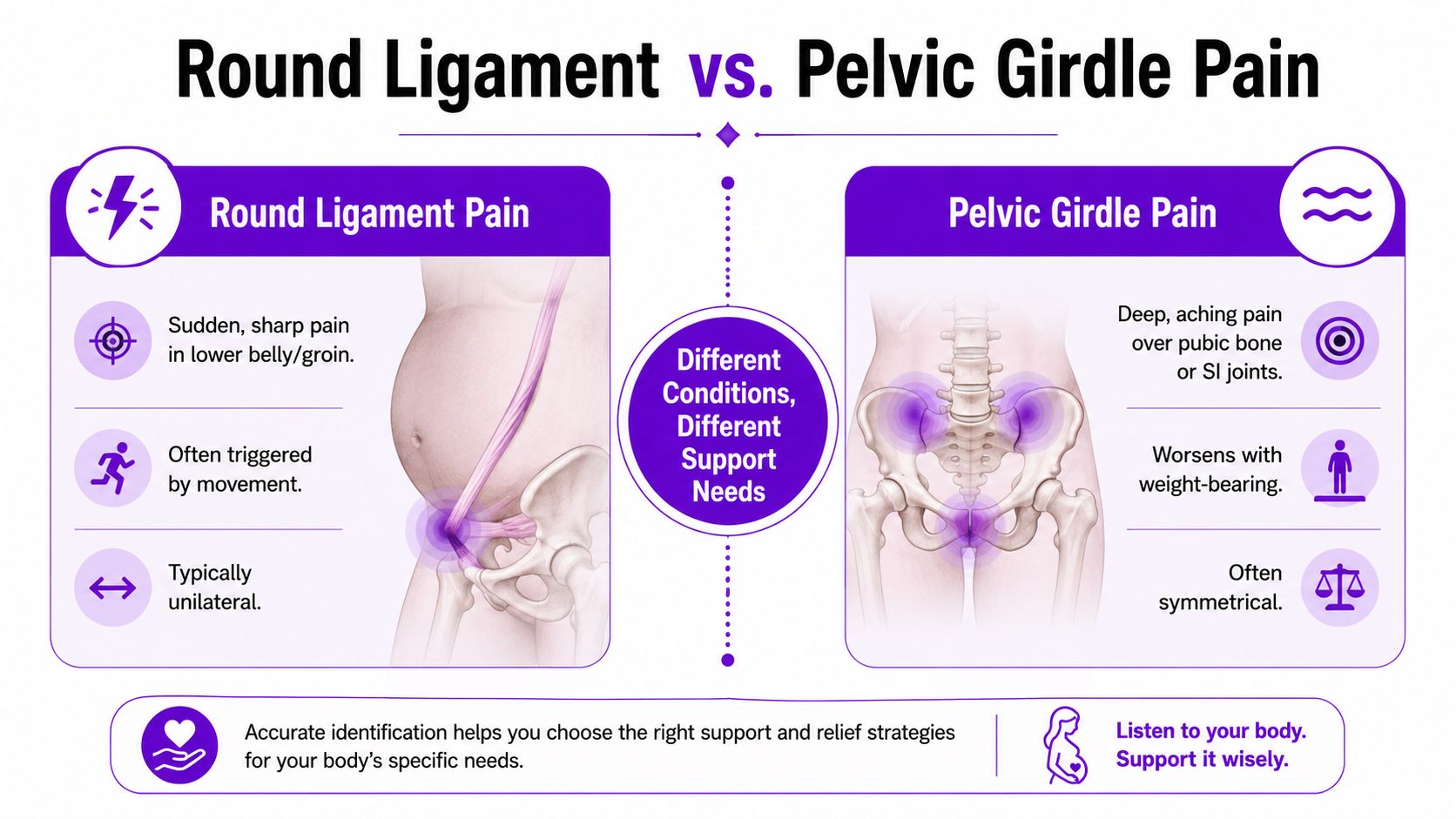 A chart comparing round ligament pain and pelvic girdle pain symptoms during pregnancy for easier identification.